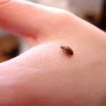 Home Remedies for Bed Bugs with Vinegar home remedies for bed bugs with vinegar